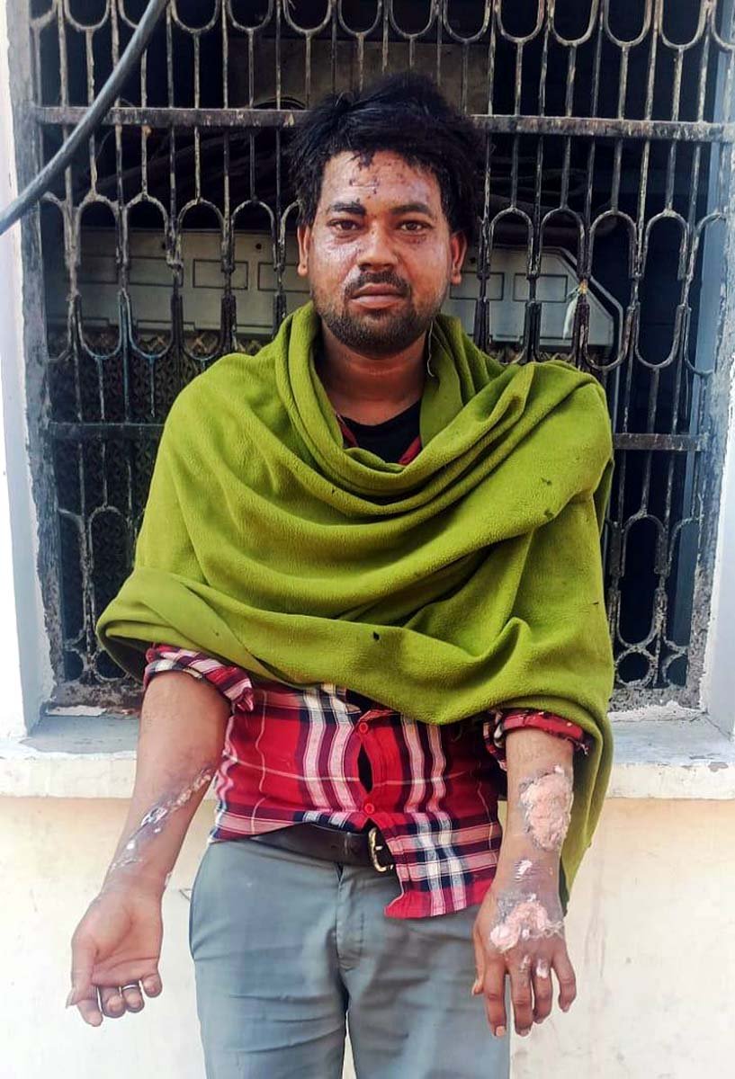 सिलेण्डर में लगी आग, ब्लास्ट होने से 6 लोग गंभीर घायल